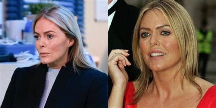 Is Patsy Kensit No Stranger to Plastic Surgery? The Truth Exposed!